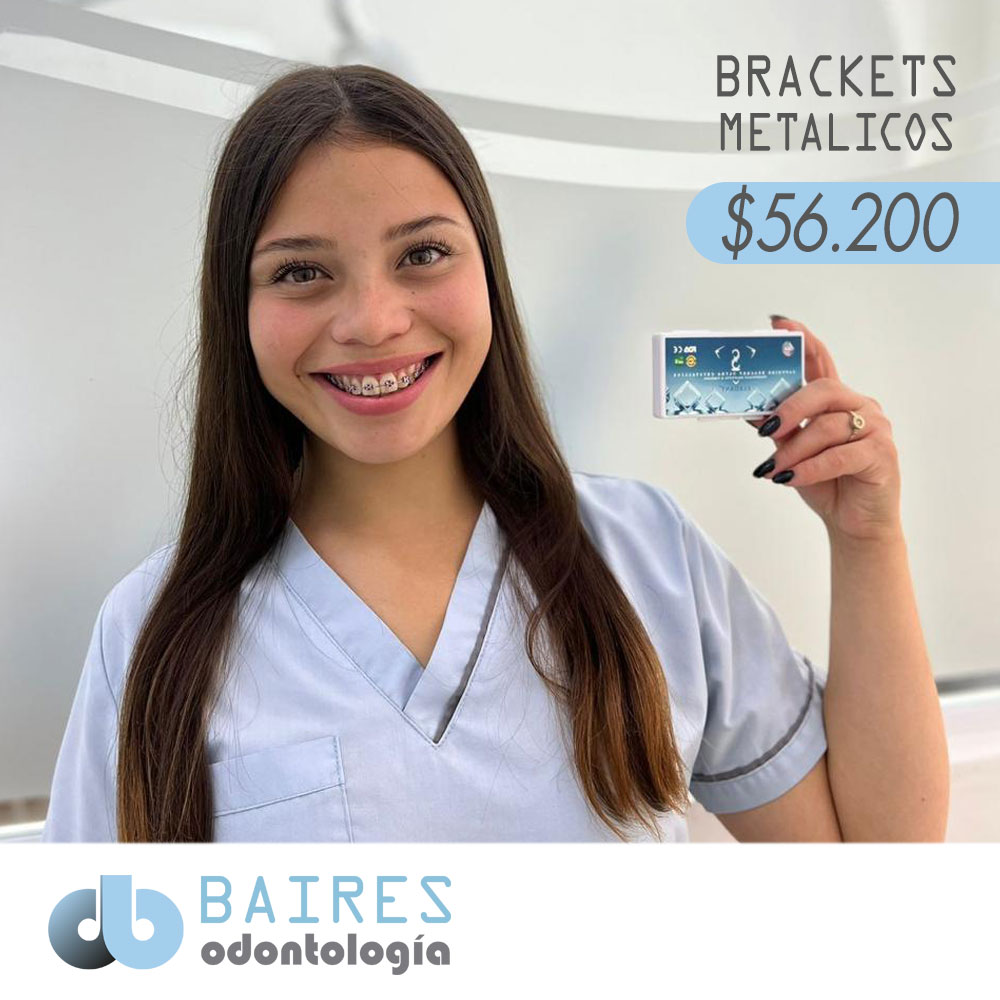 Promoción de Brackets Metalicos en Buenos Aires